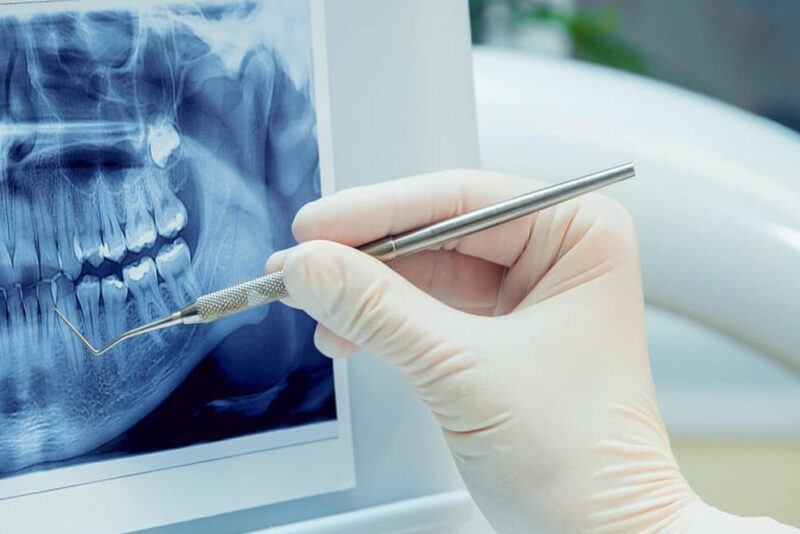 dentalna medicina opća i dječja